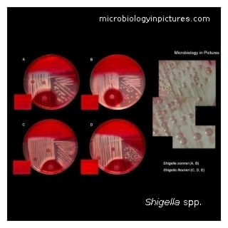 shigella